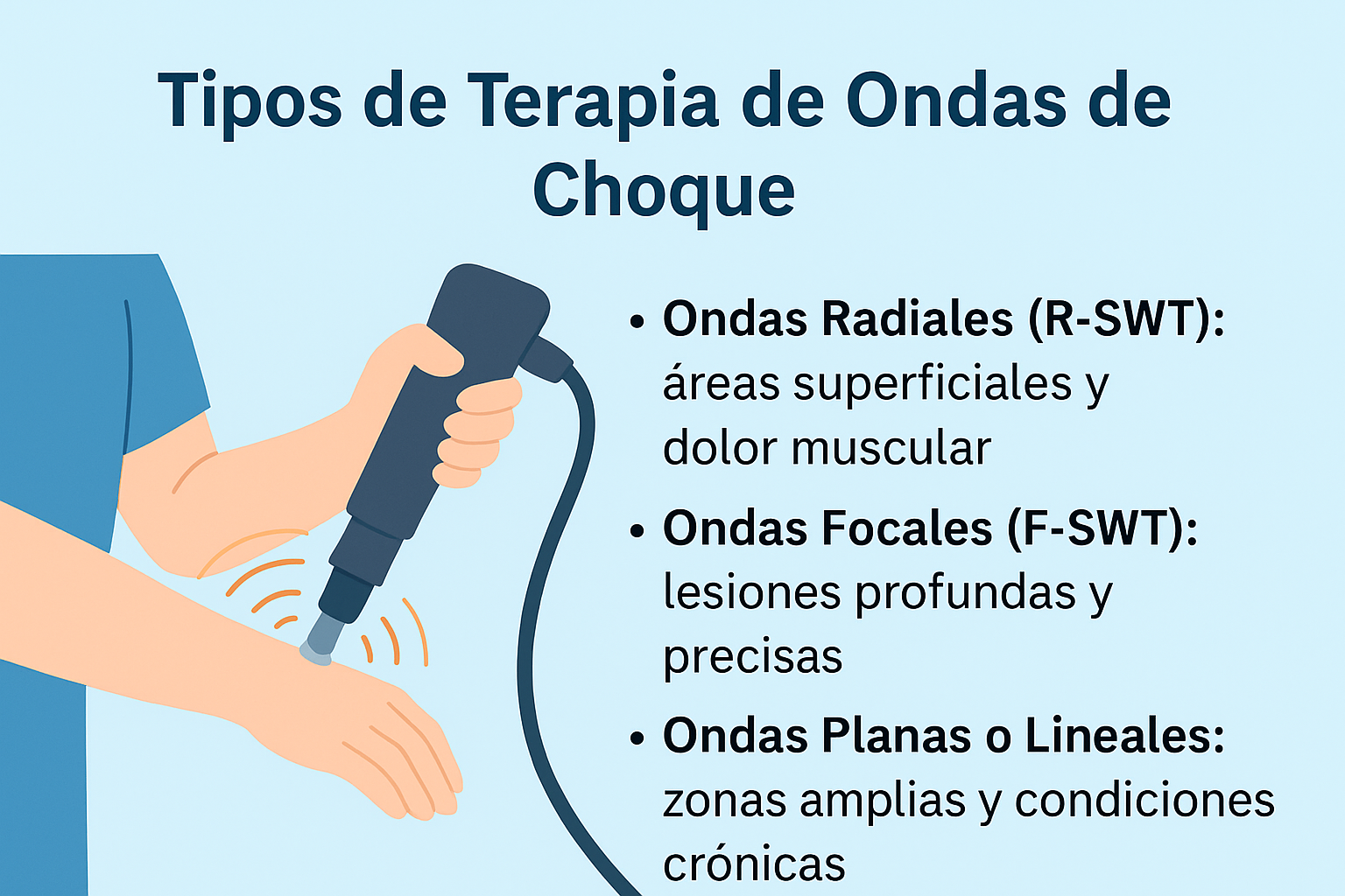 ¿Qué tipos de ondas de choque hay?