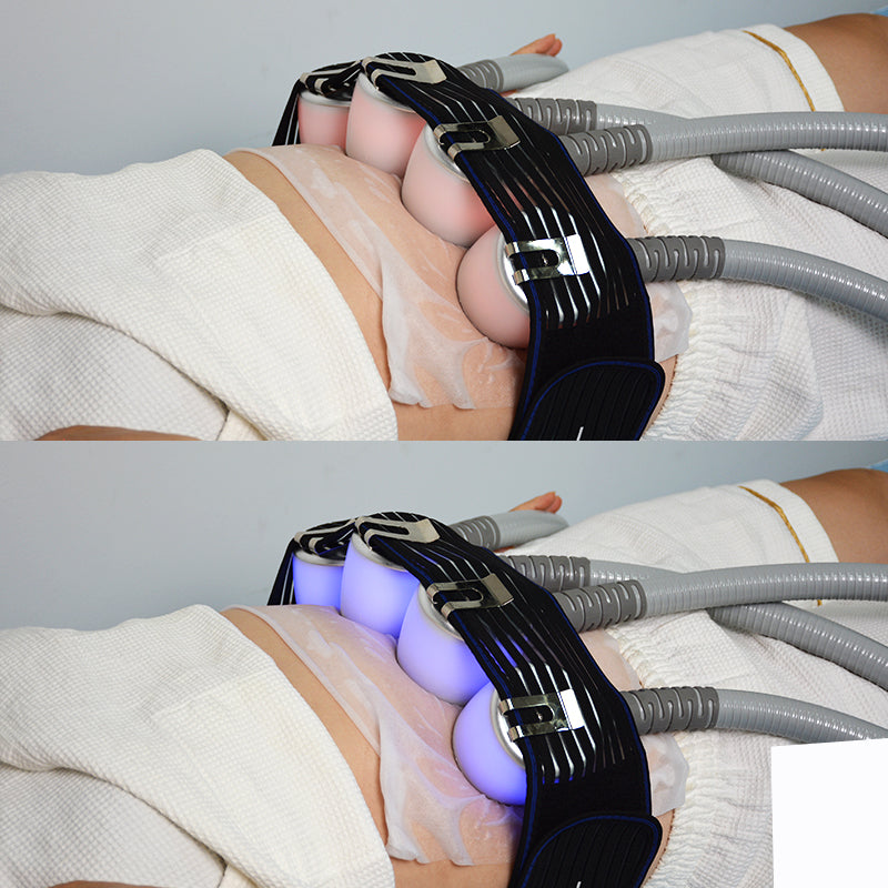 Vertical C11 Cryoskin Device Cryotherapy Cryo Tshock Thermal Shock Equipment