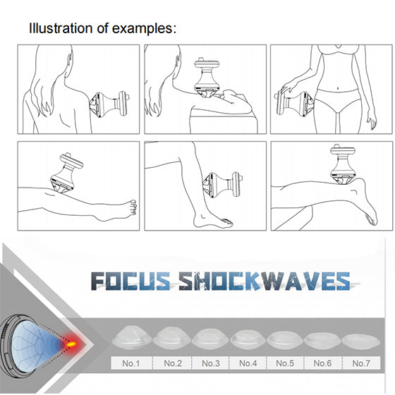 Máquina de terapia de ondas de choque piezoeléctricas focalizadas Focus Shockwaves: sistema de alivio del dolor y rehabilitación