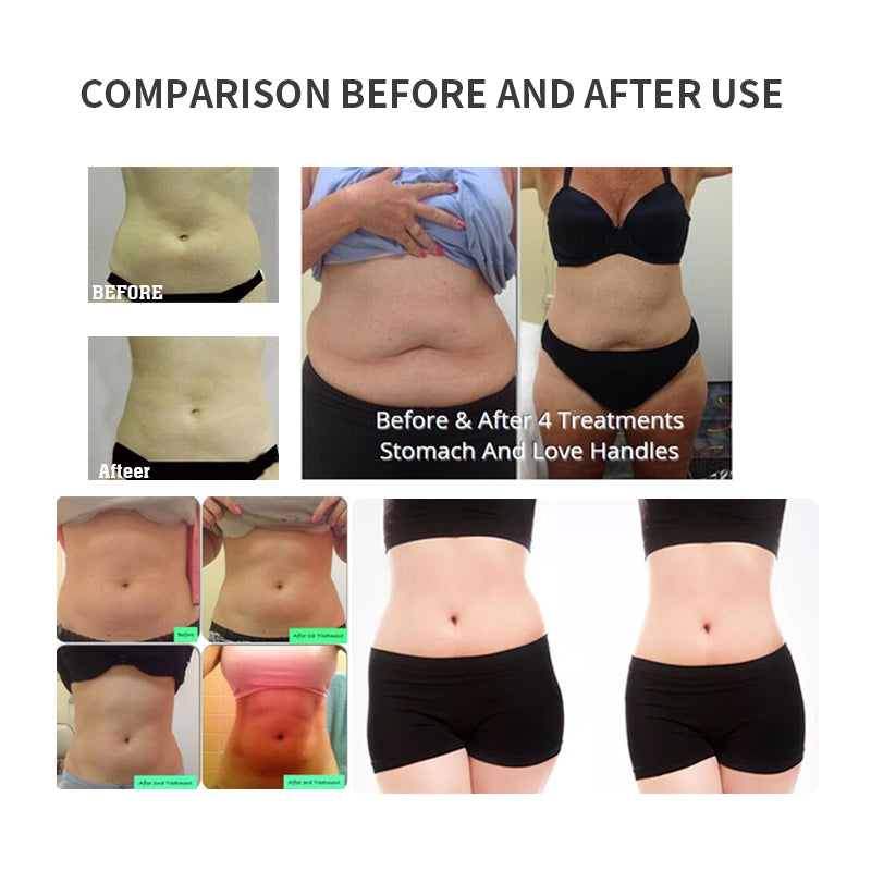 Tecar Therapy Physiotherapy Factory Price Indiba Machine 448Khz Cet Ret Rf Device