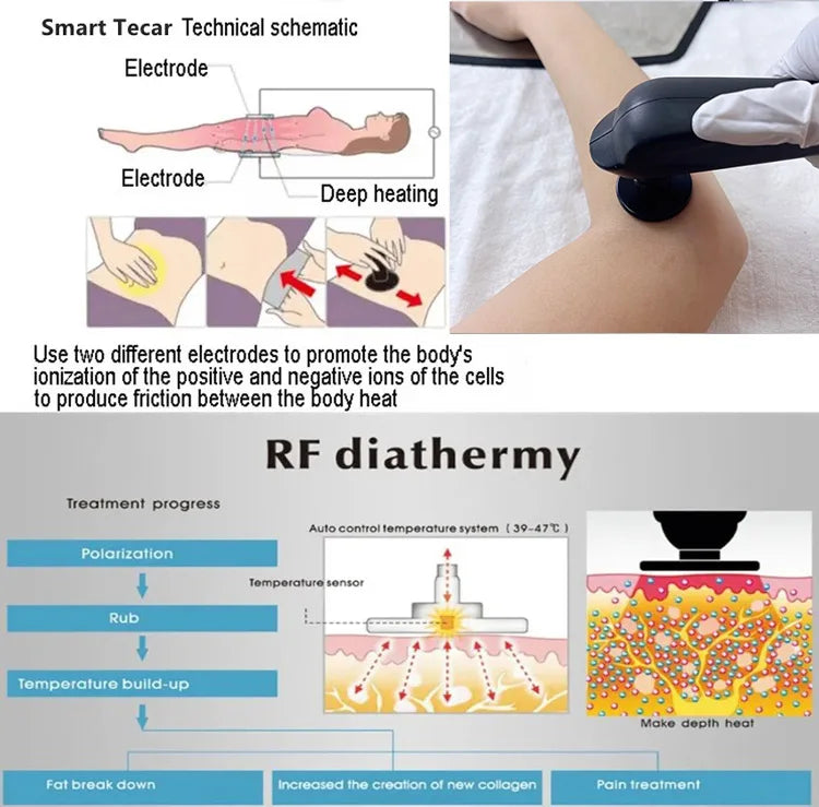 Máquina de diatermia adelgazante con radiofrecuencia monopolar CET RET de 448 K para el cuidado corporal y el calentamiento profundo, terapia muscular Tecar RF y fisioterapia.