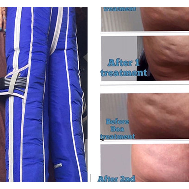 BR615 High Waist Pressotherapy Suit | 24 Air compression Chambers Lymphatic Drainage Massage detox therapy Machine