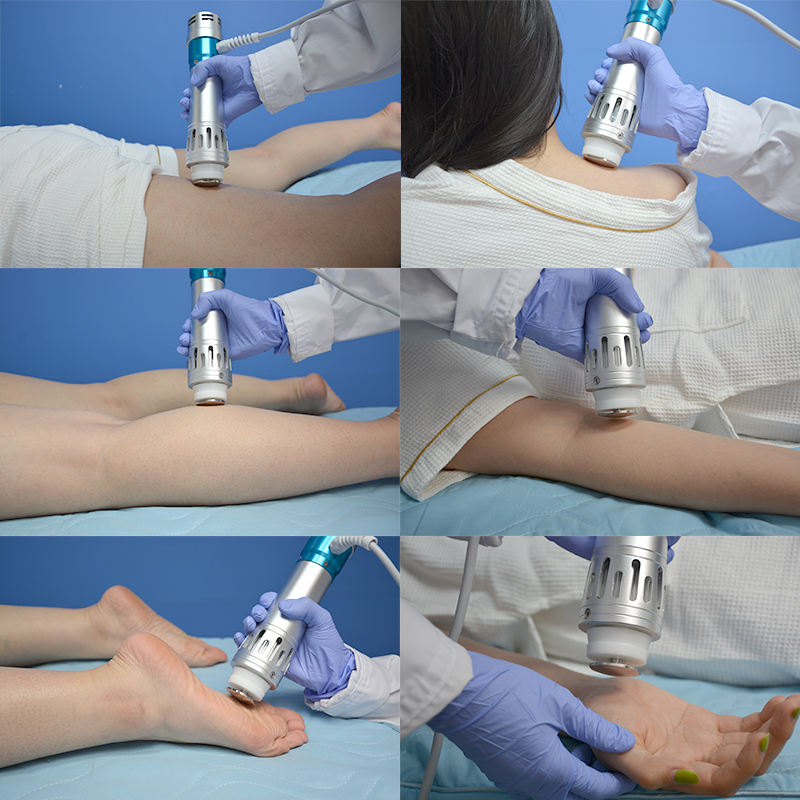 SW15 Electromagnetic Shockwave Therapy Machine – 120mJ, 16Hz, Pain Relief & ED Treatment